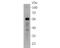 Bone Morphogenetic Protein 15 antibody, NBP2-80452, Novus Biologicals, Western Blot image 