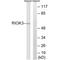 RIO Kinase 3 antibody, A09262, Boster Biological Technology, Western Blot image 