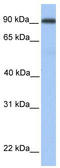 Membrane Metalloendopeptidase Like 1 antibody, TA342060, Origene, Western Blot image 