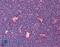 T Cell Immunoglobulin And Mucin Domain Containing 4 antibody, LS-B598, Lifespan Biosciences, Immunohistochemistry frozen image 
