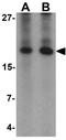 Angiogenin antibody, GTX17177, GeneTex, Western Blot image 