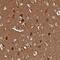 ADAM Metallopeptidase With Thrombospondin Type 1 Motif 18 antibody, PA5-60675, Invitrogen Antibodies, Immunohistochemistry frozen image 