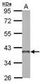 DNA-(apurinic or apyrimidinic site) lyase antibody, GTX107122, GeneTex, Western Blot image 