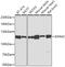 Dynamin 2 antibody, GTX64478, GeneTex, Western Blot image 