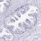 Tissue factor pathway inhibitor 2 antibody, NBP2-33552, Novus Biologicals, Immunohistochemistry paraffin image 