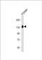 Ectonucleotide Pyrophosphatase/Phosphodiesterase 2 antibody, PA5-72362, Invitrogen Antibodies, Western Blot image 