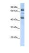 Growth Arrest Specific 2 Like 1 antibody, NBP1-58112, Novus Biologicals, Western Blot image 