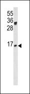 Joining Chain Of Multimeric IgA And IgM antibody, 62-317, ProSci, Western Blot image 