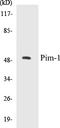 Pim-1 Proto-Oncogene, Serine/Threonine Kinase antibody, EKC1460, Boster Biological Technology, Western Blot image 