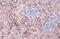 Acyl-CoA Synthetase Long Chain Family Member 4 antibody, GTX635616, GeneTex, Immunohistochemistry paraffin image 