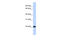 Kruppel Like Factor 16 antibody, 25-543, ProSci, Western Blot image 