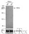 Tet Methylcytosine Dioxygenase 2 antibody, GTX629881, GeneTex, Western Blot image 