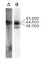 Elastin antibody, NB100-2076, Novus Biologicals, Western Blot image 