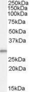 TPD52 Like 2 antibody, GTX88975, GeneTex, Western Blot image 