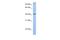 Yip1 Domain Family Member 1 antibody, A15862, Boster Biological Technology, Western Blot image 