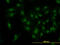 Cyclin Dependent Kinase 6 antibody, LS-B5388, Lifespan Biosciences, Immunofluorescence image 