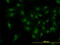 Cyclin Dependent Kinase 6 antibody, LS-B5388, Lifespan Biosciences, Immunofluorescence image 