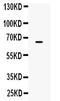 Carboxypeptidase M antibody, A01650, Boster Biological Technology, Western Blot image 