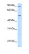 Glutamic--Pyruvic Transaminase antibody, orb330439, Biorbyt, Western Blot image 