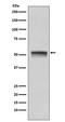 Checkpoint Kinase 1 antibody, M01060, Boster Biological Technology, Western Blot image 