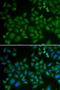 Sphingomyelin Phosphodiesterase 1 antibody, LS-C334919, Lifespan Biosciences, Immunofluorescence image 