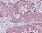 BAX antibody, M00183-1, Boster Biological Technology, Immunohistochemistry paraffin image 