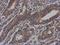 Vezatin, Adherens Junctions Transmembrane Protein antibody, NBP2-20855, Novus Biologicals, Immunohistochemistry frozen image 