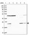 Mitochondrial Ribosomal Protein L17 antibody, NBP2-13611, Novus Biologicals, Western Blot image 