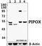 Pipecolic Acid And Sarcosine Oxidase antibody, A10475-1, Boster Biological Technology, Western Blot image 