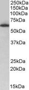 Isocitrate Dehydrogenase (NADP(+)) 2, Mitochondrial antibody, 42-704, ProSci, Enzyme Linked Immunosorbent Assay image 