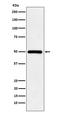 Lysine Methyltransferase 5A antibody, M05349, Boster Biological Technology, Western Blot image 