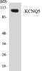 Potassium Voltage-Gated Channel Subfamily Q Member 5 antibody, LS-C292119, Lifespan Biosciences, Western Blot image 