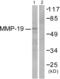 Matrix Metallopeptidase 19 antibody, abx013146, Abbexa, Western Blot image 