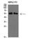 Interleukin 17 Receptor B antibody, STJ98612, St John