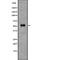 Beta-Secretase 1 antibody, abx148521, Abbexa, Western Blot image 
