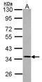 Protein Phosphatase 4 Catalytic Subunit antibody, NBP2-19912, Novus Biologicals, Western Blot image 