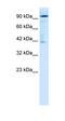 OTU Deubiquitinase 7B antibody, orb324558, Biorbyt, Western Blot image 