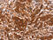 Hyaluronan Synthase 1 antibody, CSB-PA547529, Cusabio, Immunohistochemistry frozen image 