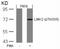 LIM Domain Kinase 2 antibody, 79-159, ProSci, Western Blot image 