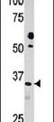 Pyridoxal Kinase antibody, PA5-13971, Invitrogen Antibodies, Western Blot image 