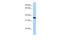 Ribosomal Protein Lateral Stalk Subunit P0 antibody, 29-222, ProSci, Enzyme Linked Immunosorbent Assay image 