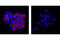 Zeta Chain Of T Cell Receptor Associated Protein Kinase 70 antibody, 2701T, Cell Signaling Technology, Immunocytochemistry image 