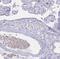 HBB antibody, NBP2-14081, Novus Biologicals, Immunohistochemistry paraffin image 