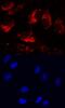 Leucine Rich Repeats And Immunoglobulin Like Domains 1 antibody, PA5-47009, Invitrogen Antibodies, Immunocytochemistry image 