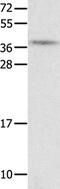 Neurotensin/neuromedin N antibody, PA5-50243, Invitrogen Antibodies, Western Blot image 