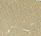 Teneurin-1 antibody, A09038, Boster Biological Technology, Immunohistochemistry paraffin image 