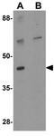 Geminin Coiled-Coil Domain Containing antibody, GTX17134, GeneTex, Western Blot image 