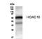 Histone Deacetylase 10 antibody, TA336684, Origene, Western Blot image 