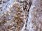 SRP Receptor Subunit Beta antibody, LS-C173930, Lifespan Biosciences, Immunohistochemistry frozen image 