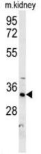 Hydroxysteroid 17-Beta Dehydrogenase 13 antibody, GTX53602, GeneTex, Western Blot image 